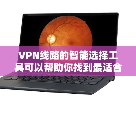 VPN线路的智能选择工具可以帮助你找到最适合你的网络选择。以下是一个详细的指南，帮助你更好地选择VPN线路